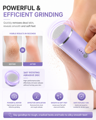 AUSHA Rechargeable Electric Foot Callus Remover