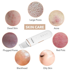 Ultrasonic Skin Cleansing & Lifting Face Scrubber