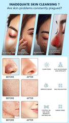 Oxygen Bubble Water Cycle Hydro Facial Cleanser