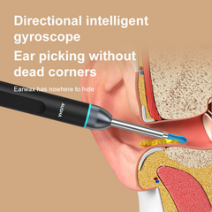 1080p FHD Ear Endoscope Otoscope Wax Cleaner Camera
