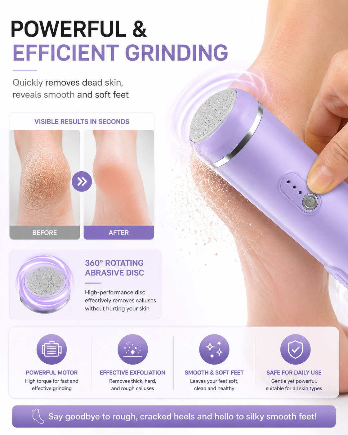AUSHA Rechargeable Electric Foot Callus Remover