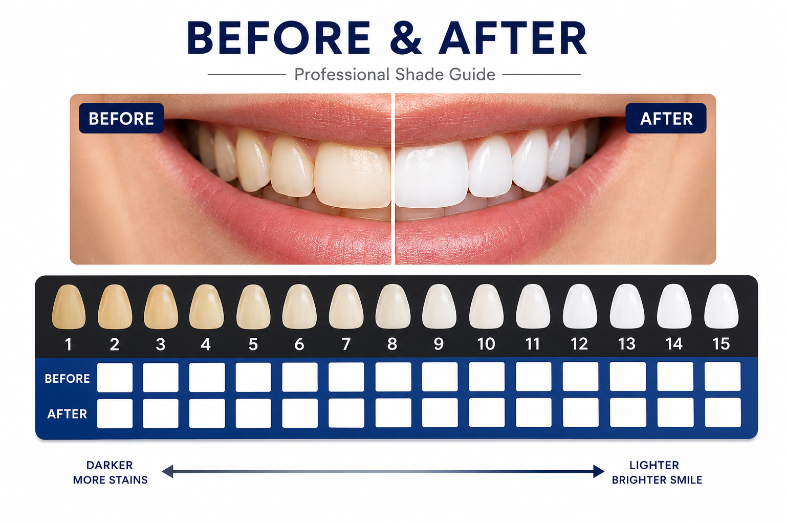 AUSHA LED Teeth Whitening Kit with LED Light