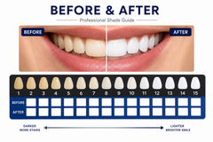 AUSHA LED Teeth Whitening Kit with LED Light